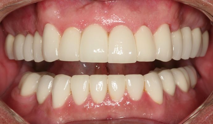 Restorative Dentistry: Case 2 - After