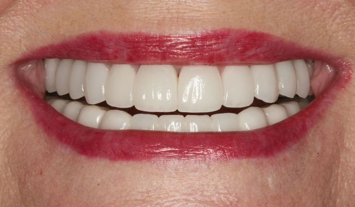 Restorative Dentistry: Case 3 - After