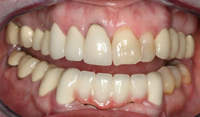 Restorative Dentistry: Case 3 - Before