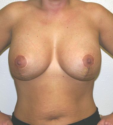 Large image