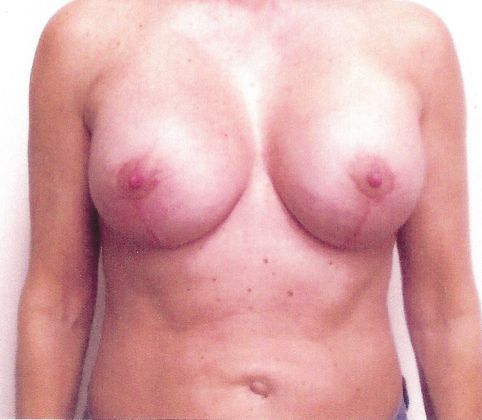 Large image