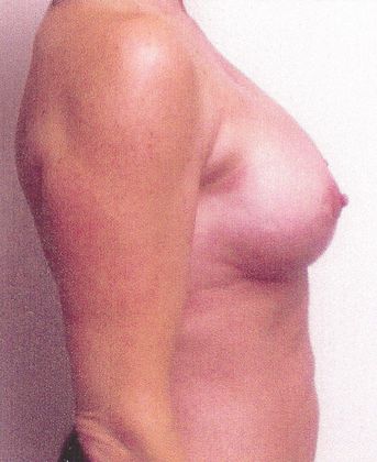Large image