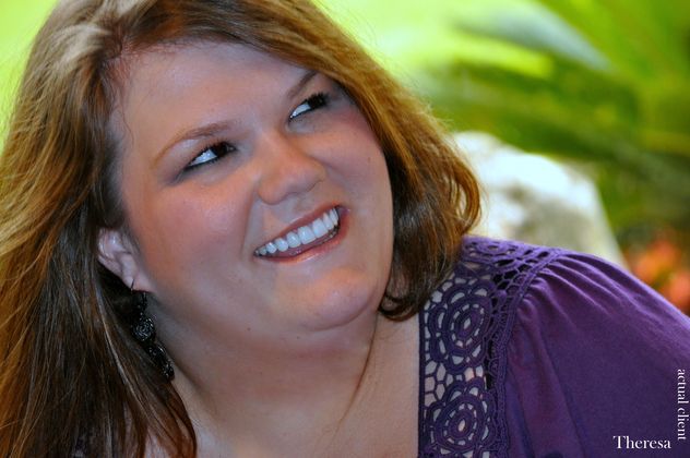 Veneers: Case 1 - After