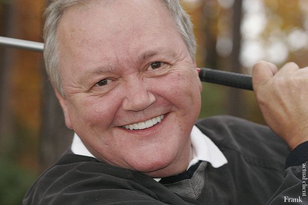 Veneers: Case 3 - After