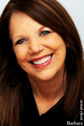 Veneers: Case 4 - After