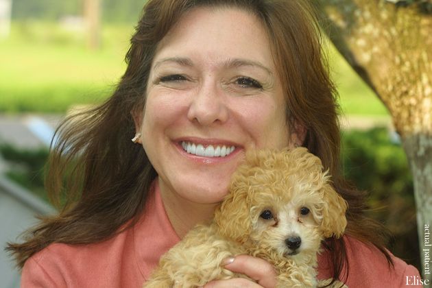 Veneers: Case 7 - After