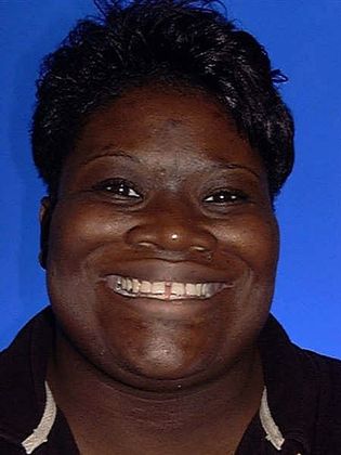 Veneers: Case 6 - Before