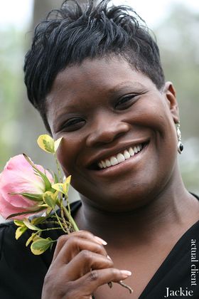 Veneers: Case 6 - After