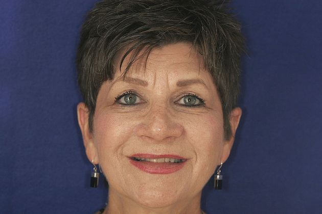 Veneers: Case 10 - Before