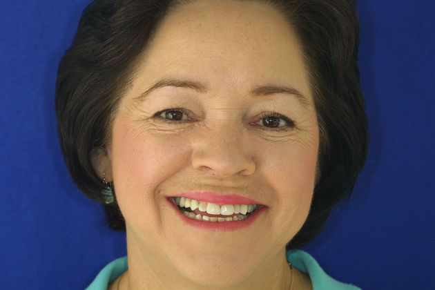 Veneers: Case 12 - Before