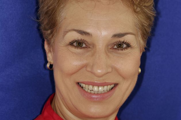 Veneers: Case 13 - Before