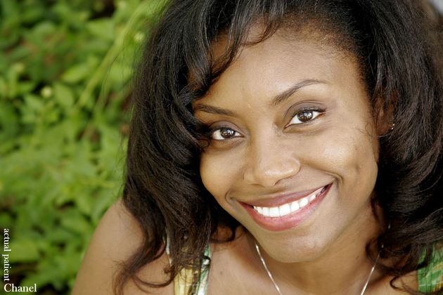 Veneers: Case 17 - After