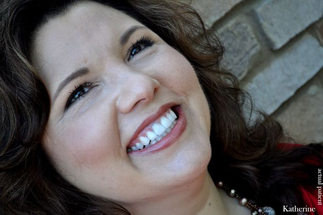 Veneers: Case 19 - After