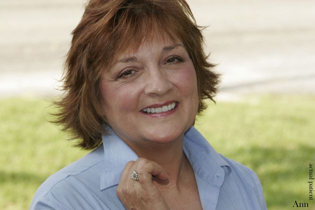 Veneers: Case 20 - After