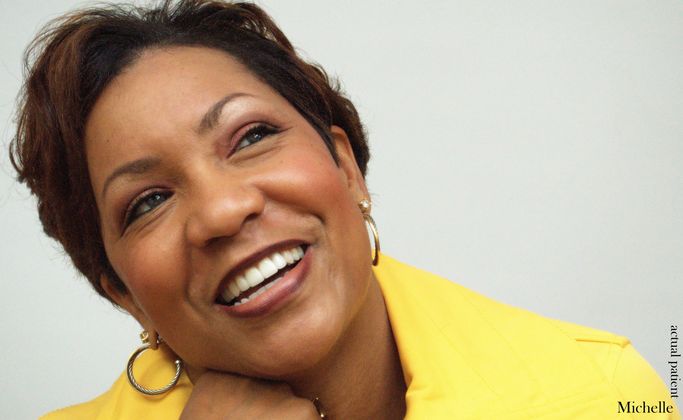 Veneers: Case 21 - After