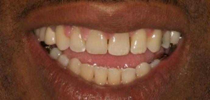 Orthodontics Case 1 - After