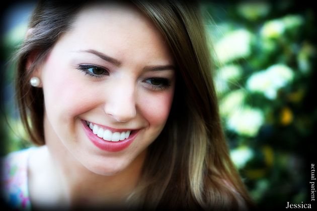 Veneers: Case 25 - After