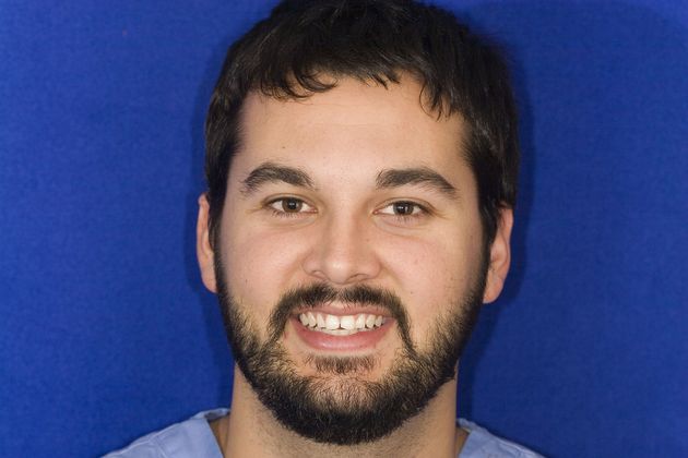 Veneers: Case 26 - Before