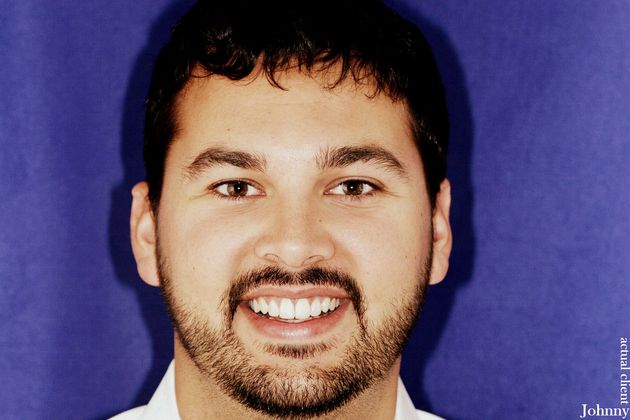 Veneers: Case 26 - After