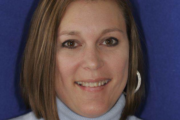 Veneers: Case 29 - Before