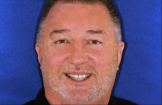 Veneers: Case 31 - Before