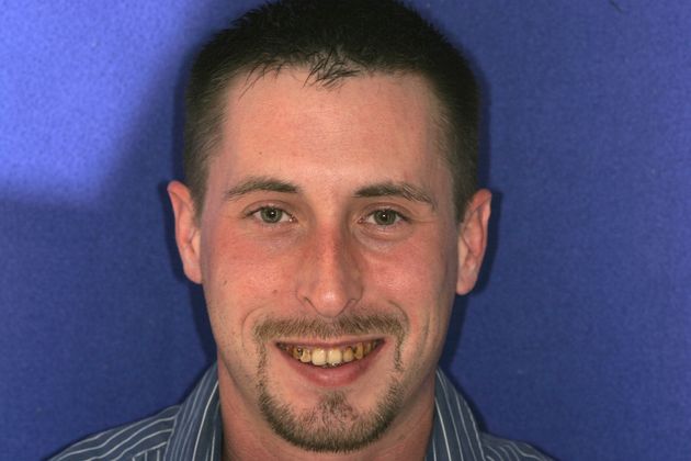 Veneers: Case 32 - Before