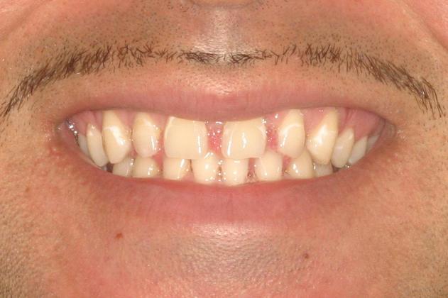 Cosmetic Dentistry: Case 5 - Before