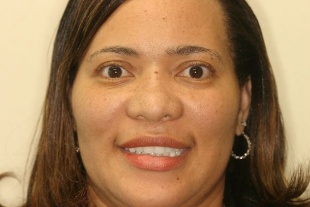 Cosmetic Dentistry: Case 6 - After