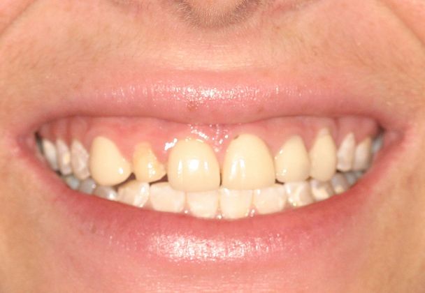 Cosmetic Dentistry: Case 7 - Before