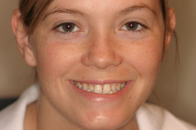 Cosmetic Dentistry: Case 9 - Before