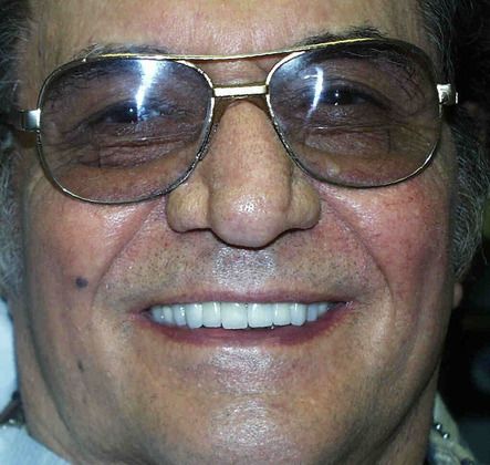 Replacing Missing Teeth Case 4 - After