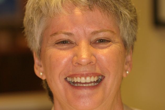 Cosmetic Dentistry: Case 11 - After