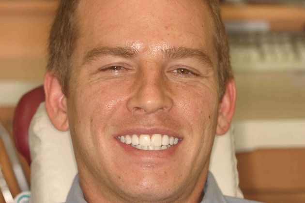 Cosmetic Dentistry: Case 12 - After