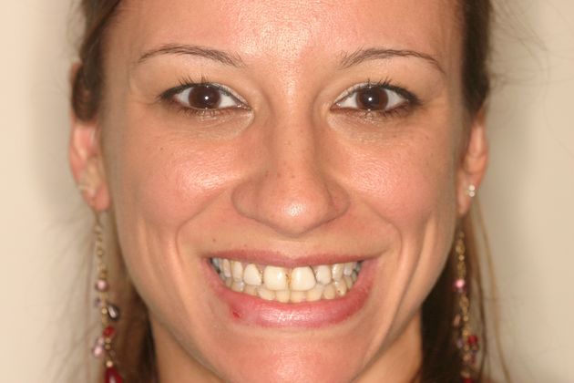 Cosmetic Dentistry: Case 13 - Before