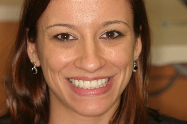 Cosmetic Dentistry: Case 13 - After