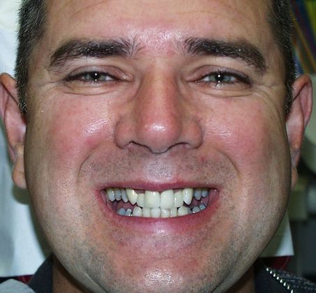 Cosmetic Dentistry: Case 14 - Before