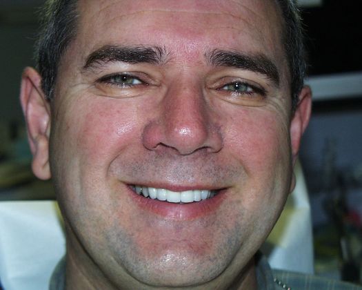 Cosmetic Dentistry: Case 14 - After