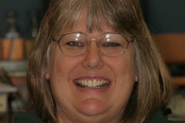 Cosmetic Dentistry: Case 16 - After