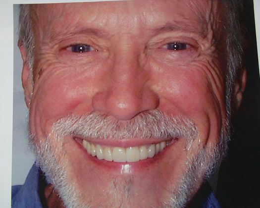 Cosmetic Dentistry: Case 18 - After