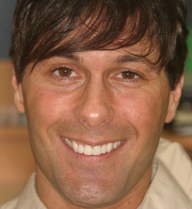 Cosmetic Dentistry: Case 19 - After