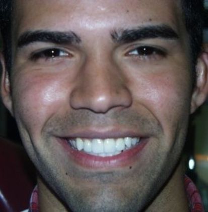 Cosmetic Dentistry: Case 22 - After