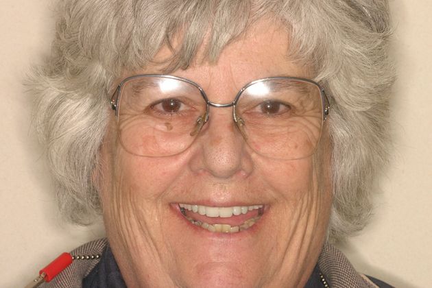 Cosmetic Dentistry: Case 23 - After