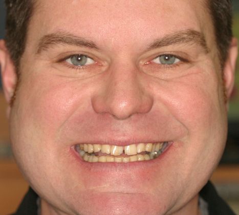 Cosmetic Dentistry: Case 25 - Before