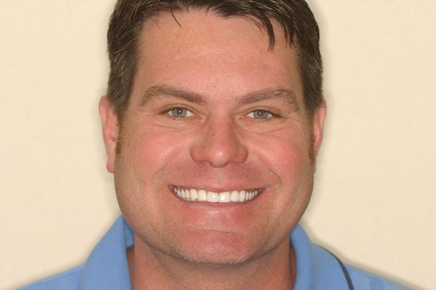 Cosmetic Dentistry: Case 25 - After