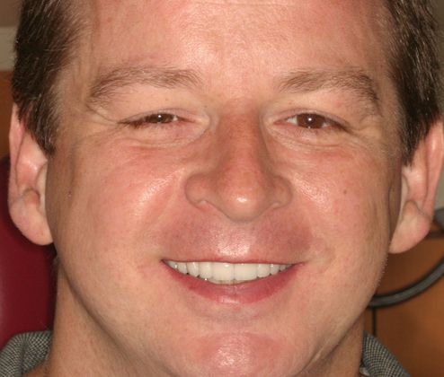 Cosmetic Dentistry: Case 28 - After