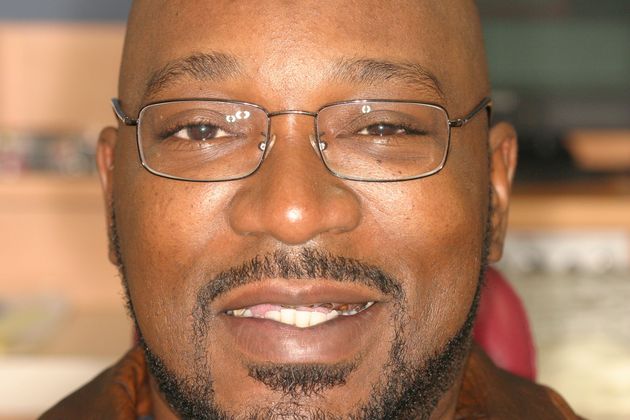 Replacing Missing Teeth Case 8 - Before