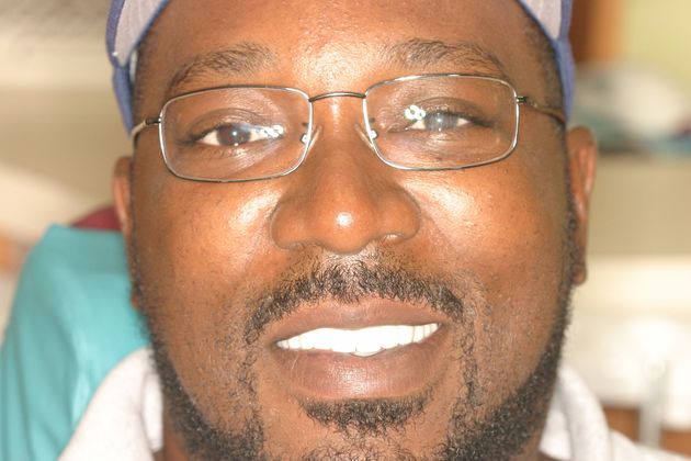 Replacing Missing Teeth: Case 8 - After