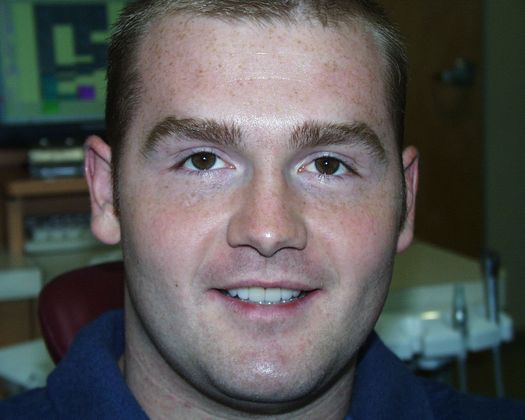 Cosmetic Dentistry: Case 34 - After