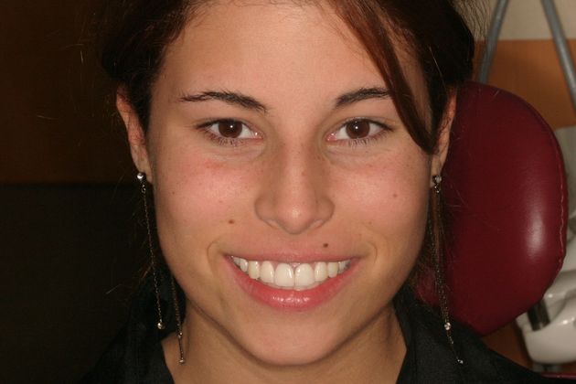 Cosmetic Dentistry: Case 35 - After