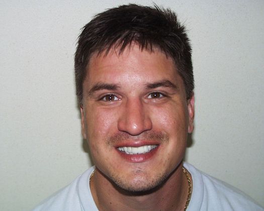 Cosmetic Dentistry: Case 38 - After